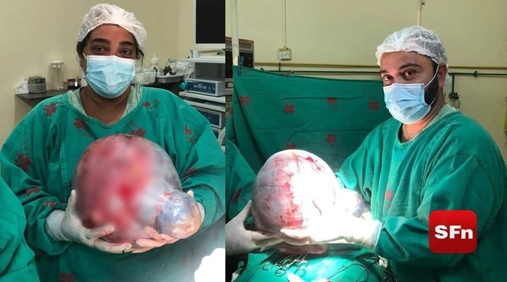 Bem Estar - HC retira cisto gigante de ovário por cirurgia minimamente  invasiva